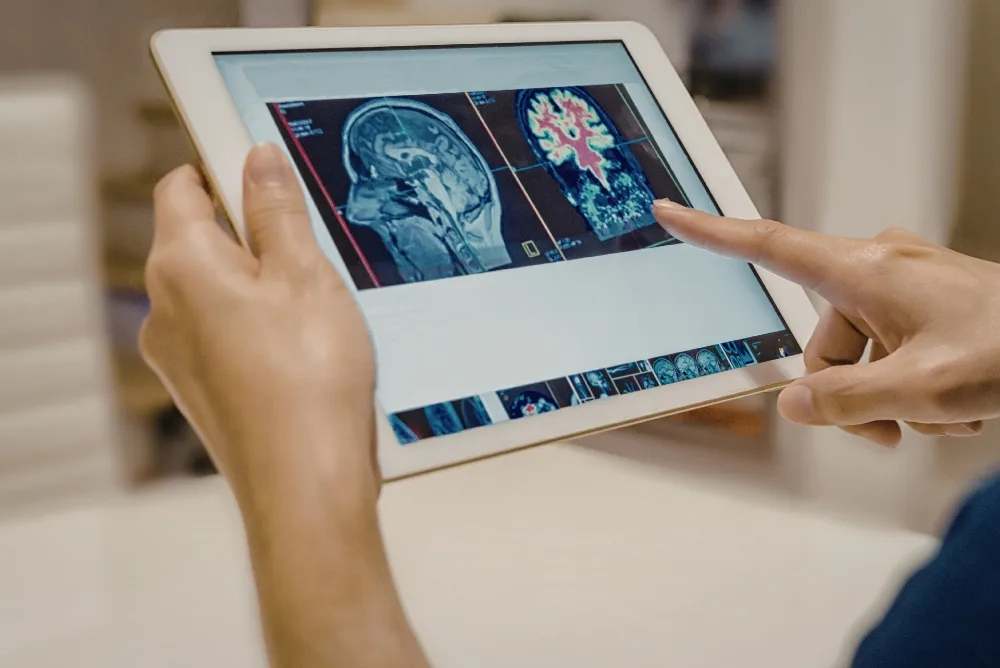 Recognizing Brain Aneurysm Symptoms and Diagnosis